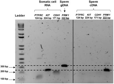 Identification of differentially expressed mRNAs and miRNAs in spermatozoa of bulls of varying fertility